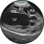 Ultrasound and Radiological Reading Services