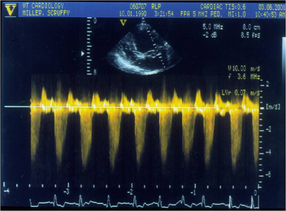 Cardiac Ultrasound Course with Dr. Pyle